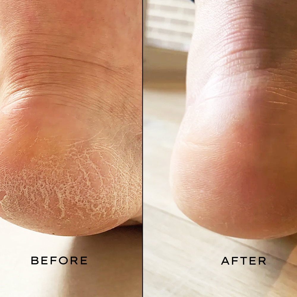 Heel Balm 50mL - Single