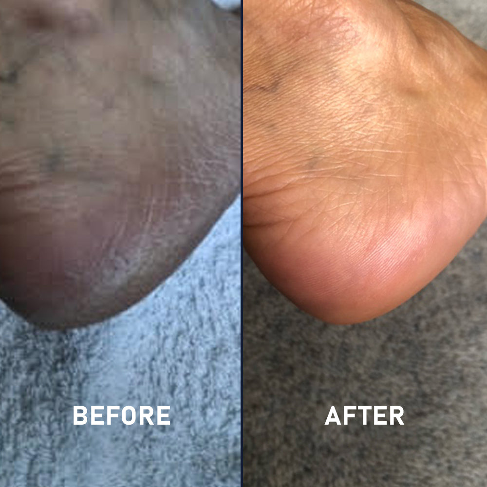 Full Foot Silicone Socks - 3 Pack