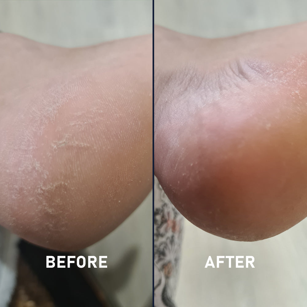 Full Sock Kit & Sockette Kit Bundle