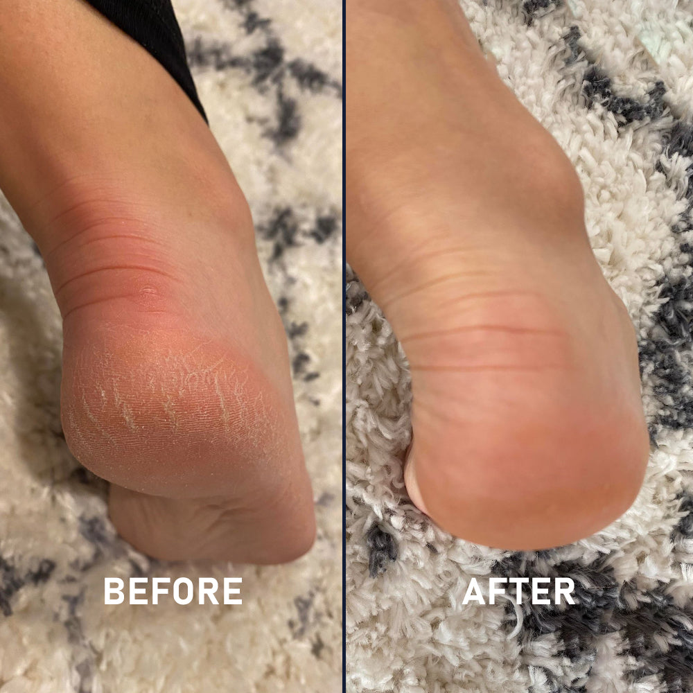 Full Silicone Sock Kit - 2 Pack