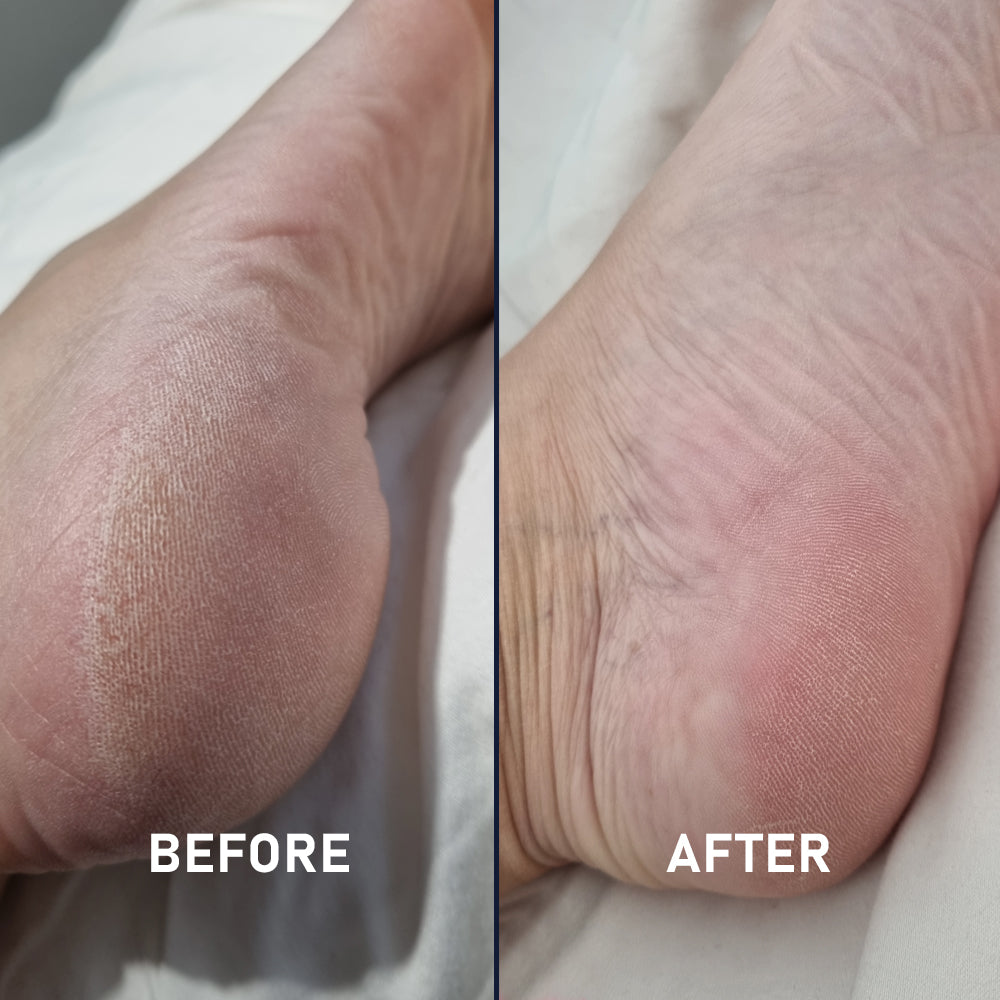 Full Silicone Sock Kit - 2 Pack