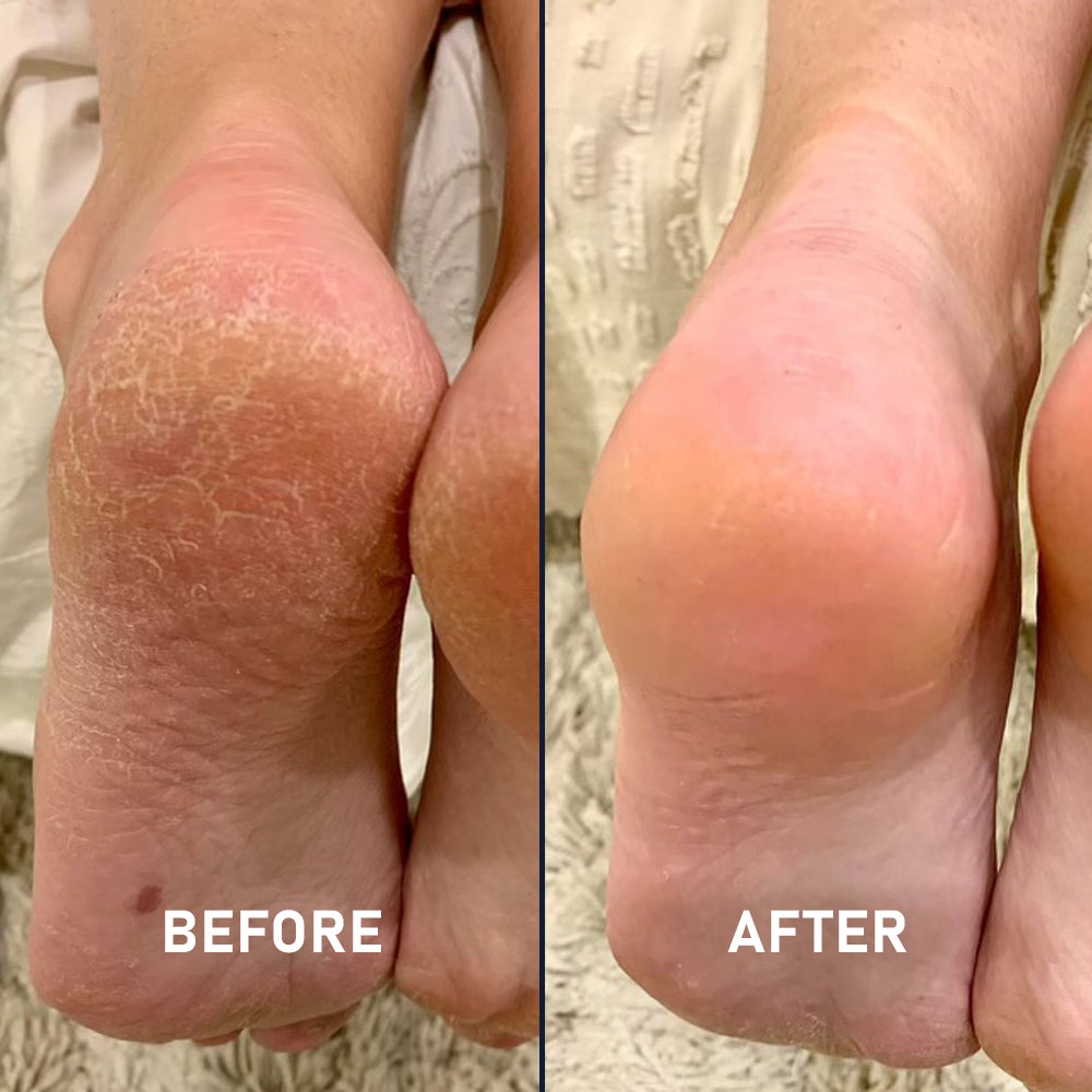 Silicone Sockette Kit - 3 Pack